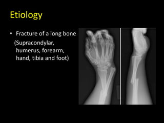 Etiology
• Fracture of a long bone
(Supracondylar,
humerus, forearm,
hand, tibia and foot)
 