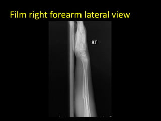 Film right forearm lateral view
 