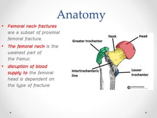 Anatomy
• Femoral neck fractures
are a subset of proximal
femoral fracture.
• The femoral neck is the
weakest part of
the Femur.
• disruption of blood
supply to the femoral
head is dependent on
the type of fracture
 