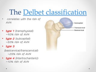 The Delbet classification
• correlates with the risk of
AVN
• type 1 (transphyseal):
~90% risk of AVN
• type 2 (subcapital):
~50% risk of AVN
• type 3
(basicervical/transcervical):
~25% risk of AVN
• type 4 (intertrochanteric):
~10% risk of AVN
 