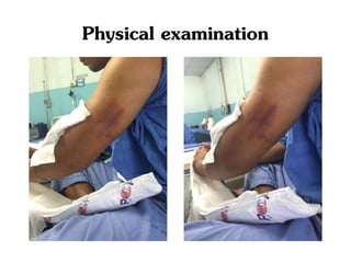 Physical examination
 