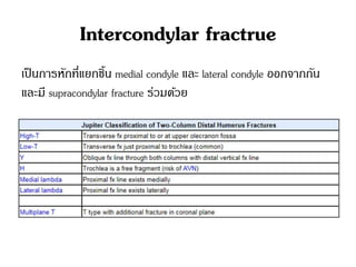 Intercondylar fractrue
เป็นการหักที่แยกชิ้น medial condyle และ lateral condyle ออกจากกัน
และมี supracondylar fracture ร่วมด้วย
 