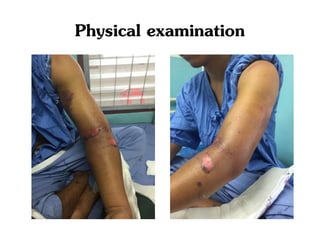 Physical examination
 