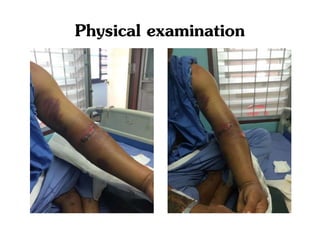 Physical examination
 