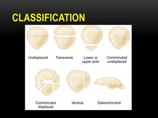 CLASSIFICATION
 