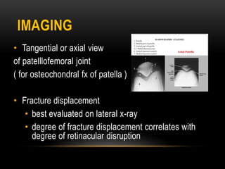 IMAGING
• Tangential or axial view
of patelllofemoral joint
( for osteochondral fx of patella )
• Fracture displacement
• best evaluated on lateral x-ray
• degree of fracture displacement correlates with
degree of retinacular disruption
 