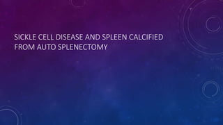 SICKLE CELL DISEASE AND SPLEEN CALCIFIED
FROM AUTO SPLENECTOMY
 