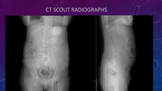 CT SCOUT RADIOGRAPHS
 