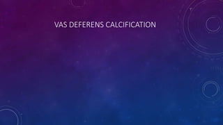 VAS DEFERENS CALCIFICATION
 