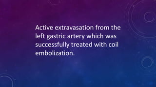 Active extravasation from the
left gastric artery which was
successfully treated with coil
embolization.
 