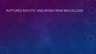 RUPTURED MYCOTIC ANEURYSM FROM BRUCELLOSIS
 