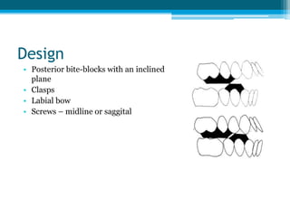 Design
• Posterior bite-blocks with an inclined
plane
• Clasps
• Labial bow
• Screws – midline or saggital
 