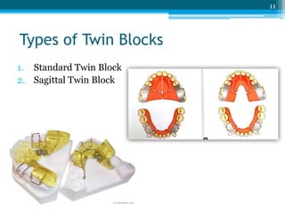 Types of Twin Blocks
1. Standard Twin Block
2. Sagittal Twin Block
11
 