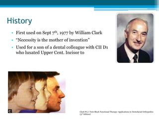 History
• First used on Sept 7th, 1977 by William Clark
• “Necessity is the mother of invention”
• Used for a son of a dental colleague with CII D1
who luxated Upper Cent. Incisor to
Clark W.J. Twin Block Functional Therapy: Applications in Dentofacial Orthopedics
(3rd Edition)
 