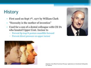History
• First used on Sept 7th, 1977 by William Clark
• “Necessity is the mother of invention”
• Used for a son of a dental colleague with CII D1
who luxated Upper Cent. Incisor to
▫ Prevent lip trap posture mandible forward
▫ Prevent direct pressure on upper incisor
Clark W.J. Twin Block Functional Therapy: Applications in Dentofacial Orthopedics
(3rd Edition)
 
