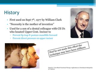 History
• First used on Sept 7th, 1977 by William Clark
• “Necessity is the mother of invention”
• Used for a son of a dental colleague with CII D1
who luxated Upper Cent. Incisor to
▫ Prevent lip trap posture mandible forward
▫ Prevent direct pressure on upper incisor
Clark W.J. Twin Block Functional Therapy: Applications in Dentofacial Orthopedics
(3rd Edition)
 