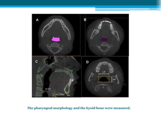 The pharyngeal morphology and the hyoid bone were measured.
 