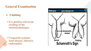 General Examination
 Clubbing
• It is painless soft-tissue
swelling of the
terminal phalanges.
• Congenital cyanotic
heart disease, Infective
endocarditis.
 