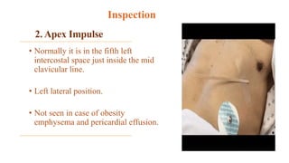 2. Apex Impulse
• Normally it is in the fifth left
intercostal space just inside the mid
clavicular line.
• Left lateral position.
• Not seen in case of obesity
emphysema and pericardial effusion.
Inspection
 