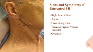 Signs and Symptoms of
Untreated PH
• Right heart failure
• Ascites
• Liver enlargement
• Increase Jugular Venous
Pressure
• Cyanosis
 