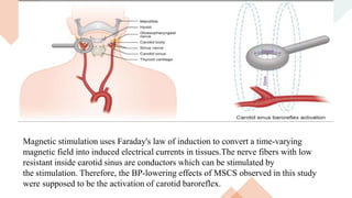 Magnetic stimulation uses Faraday's law of induction to convert a time‐varying
magnetic field into induced electrical currents in tissues.The nerve fibers with low
resistant inside carotid sinus are conductors which can be stimulated by
the stimulation. Therefore, the BP‐lowering effects of MSCS observed in this study
were supposed to be the activation of carotid baroreflex.
 