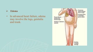 • In advanced heart failure, edema
may involve the legs, genitalia
and trunk.
 Edema
 