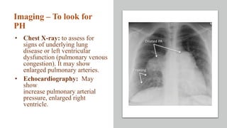 • Spirometry: to look for chronic lung disease.
• Ventilation/ Perfusion Scan: to look for
thromboembolic disease.
• Autoa...