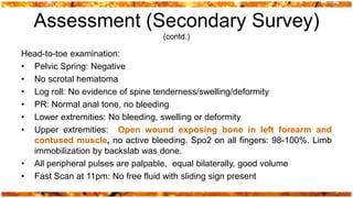 Assessment (Secondary Survey)
                                 (contd.)

Head-to-toe examination:
• Pelvic Spring: Negative
• No scrotal hematoma
• Log roll: No evidence of spine tenderness/swelling/deformity
• PR: Normal anal tone, no bleeding
• Lower extremities: No bleeding, swelling or deformity
• Upper extremities: Open wound exposing bone in left forearm and
  contused muscle, no active bleeding. Spo2 on all fingers: 98-100%. Limb
  immobilization by backslab was done.
• All peripheral pulses are palpable, equal bilaterally, good volume
• Fast Scan at 11pm: No free fluid with sliding sign present
 