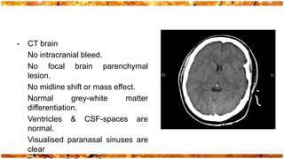 -   CT brain
    No intracranial bleed.
    No focal brain parenchymal
    lesion.
    No midline shift or mass effect.
    Normal        grey-white     matter
    differentiation.
    Ventricles & CSF-spaces are
    normal.
    Visualised paranasal sinuses are
    clear
 