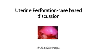 Uterine Perforation-case based
discussion
Dr .KG Hewawitharana
 