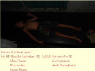 Position of limbs in supine: 
Left UE: Shoulder Abduction + ER Left LE: Hip neutral or ER 
Elbow Flexion Knee Extension 
Wrist neutral Ankle Plantarflexion 
Fingers flexion 
 