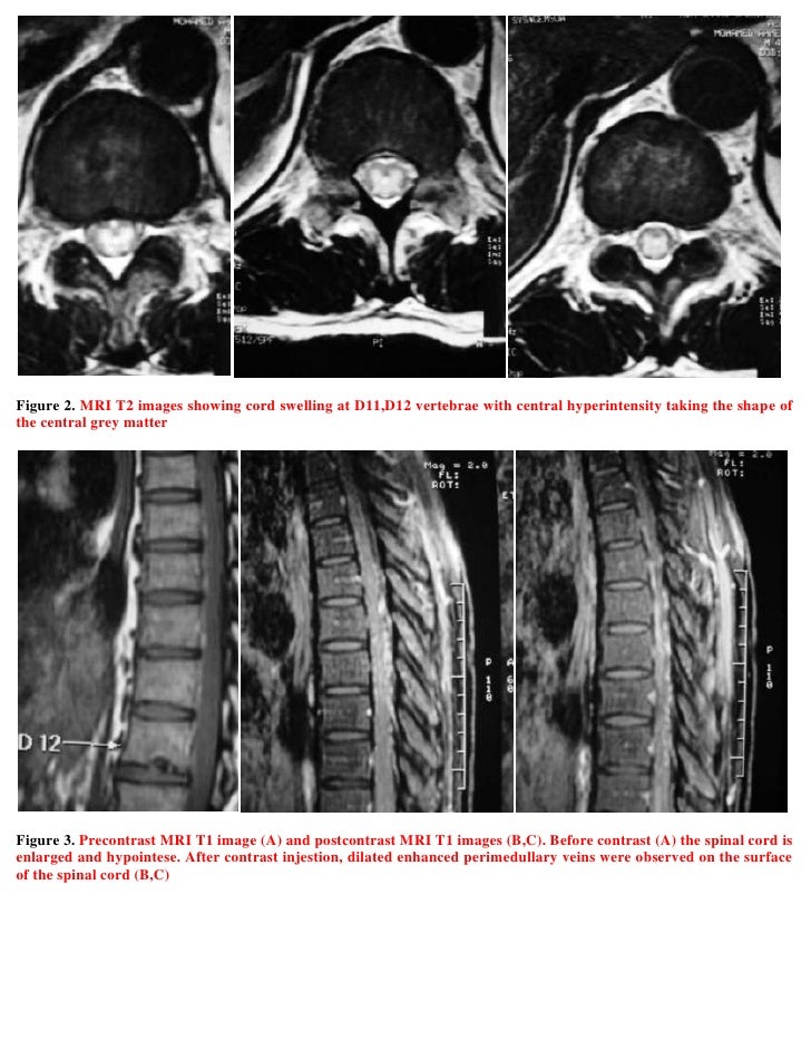 Xray record of the spinal cord