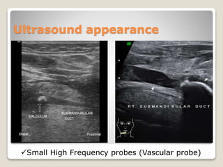 Ultrasound appearance
Small High Frequency probes (Vascular probe)
 