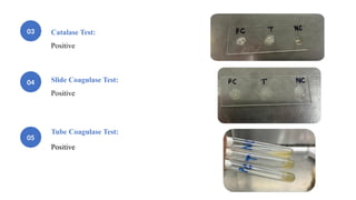 Case Exercise-identification of bacterial isolate from blood sample in ...