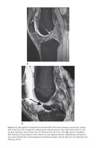TOP 10 EXAMPLES CASE FILES (ORTHOPAEDIC SURGERY).pdf