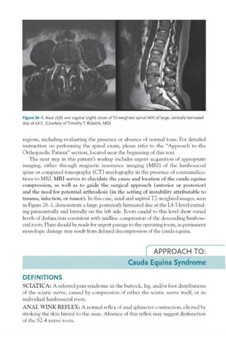 TOP 10 EXAMPLES CASE FILES (ORTHOPAEDIC SURGERY).pdf