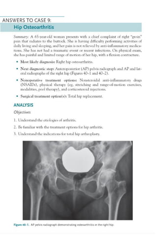 TOP 10 EXAMPLES CASE FILES (ORTHOPAEDIC SURGERY).pdf