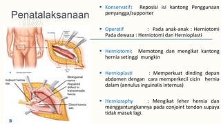 Penatalaksanaan
 Konservatif: Reposisi isi kantong Penggunaan
penyangga/supporter
 Operatif : Pada anak-anak : Herniotomi
Pada dewasa : Herniotomi dan Hernioplasti
 Herniotomi: Memotong dan mengikat kantong
hernia setinggi mungkin
 Hernioplasti : Memperkuat dinding depan
abdomen dengan cara memperkecil cicin hernia
dalam (annulus inguinalis internus)
 Hernioraphy : Mengikat leher hernia dan
menggantungkannya pada conjoint tendon supaya
tidak masuk lagi.
 