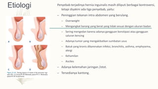 Etiologi Penyebab terjadinya hernia inguinalis masih diliputi berbagai kontroversi,
tetapi diyakini ada tiga penyebab, yaitu:
– Peninggian tekanan intra abdomen yang berulang.
– Overweight
– Mengangkat barang yang berat yang tidak sesuai dengan ukuran badan
– Sering mengedan karena adanya gangguan konstipasi atau gangguan
saluran kencing
– Adanya tumor yang mengakibatkan sumbatan usus
– Batuk yang kronis dikarenakan infeksi, bronchitis, asthma, emphysema,
alergi
– Kehamilan
– Ascites
– Adanya kelemahan jaringan /otot.
– Tersedianya kantong.
 