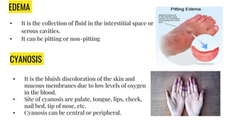 EDEMA
• It is the collection of fluid in the interstitial space or
serous cavities.
• It can be pitting or non-pitting
CYANOSIS
• It is the bluish discoloration of the skin and
mucous membranes due to low levels of oxygen
in the blood.
• Site of cyanosis are palate, tongue, lips, cheek,
nail bed, tip of nose, etc.
• Cyanosis can be central or peripheral.
 