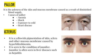 PALLOR
It is the paleness of the skin and mucous membrane caused as a result of diminished
blood supply.
• Causes of pallor:
● - Anemia
● - Shock
● - Exposure to cold
● - Heart disease
ICTERUS
• It is a yellowish pigmentation of skin, sclera
and other mucous membrane caused by
hyperbilirubinemia.
• It is seen in the condition of jaundice.
• Jaundice is often seen in liver diseases such
as hepatitis
 