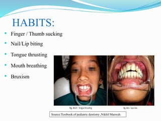HABITS:
• Finger / Thumb sucking
• Nail/Lip biting
• Tongue thrusting
• Mouth breathing
• Bruxism
Source:Textbook of pediatric dentistry ,Nikhil Marwah.
 