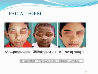 30
FACIAL FORM
(C) Mesoprosopic
Source:Textbook of principles and practice of pedodontic (Arathi Rao)
(A)Leptoprosopic (B)Euryprosopic
 
