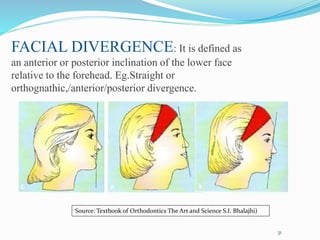 FACIAL DIVERGENCE: It is defined as
an anterior or posterior inclination of the lower face
relative to the forehead. Eg.Straight or
orthognathic,/anterior/posterior divergence.
31
Source: Textbook of Orthodontics The Art and Science S.I. Bhalajhi)
 