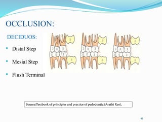 OCCLUSION:
DECIDUOS:
• Distal Step
• Mesial Step
• Flush Terminal
43
Source:Textbook of principles and practice of pedodontic (Arathi Rao),
 