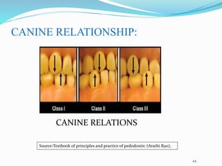 CANINE RELATIONSHIP:
44
Source:Textbook of principles and practice of pedodontic (Arathi Rao),
CANINE RELATIONS
 