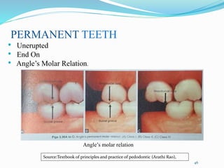 Angle’s molar relation
46
Source:Textbook of principles and practice of pedodontic (Arathi Rao),
PERMANENT TEETH
• Unerupted
• End On
• Angle’s Molar Relation.
 