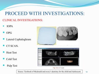 PROCEED WITH INVESTIGATIONS:
CLINICAL INVESTIGATIONS:
 IOPA
 OPG
 Lateral Cephaloghram
 CT SCAN.
 Heat Test
 Cold Test
 Pulp Test
54
Source :Textbook of Mcdonald and avery’s dentistry for the child and Adolescent.
 