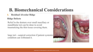 Flaring Ridge Defect CASE HISTORY CD THAT INCLUDES ALL ASPECTS DETAILED | PPTX