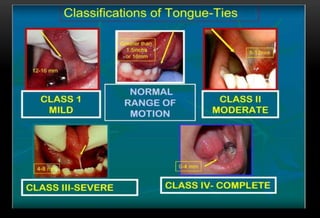 Tooth Case Classification Case history diagnosis and treatment planning in pediatric dentistry | PPTX